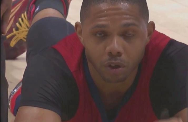 pelicans+eric+gordon+tooth+loss.jpg
