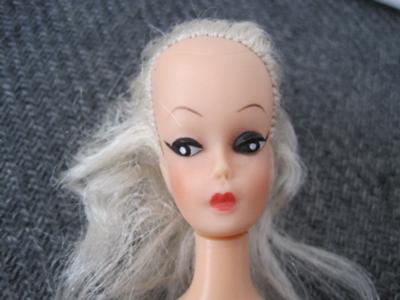 alopecia barbie