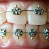 SMILE GOOD WITH BRACES