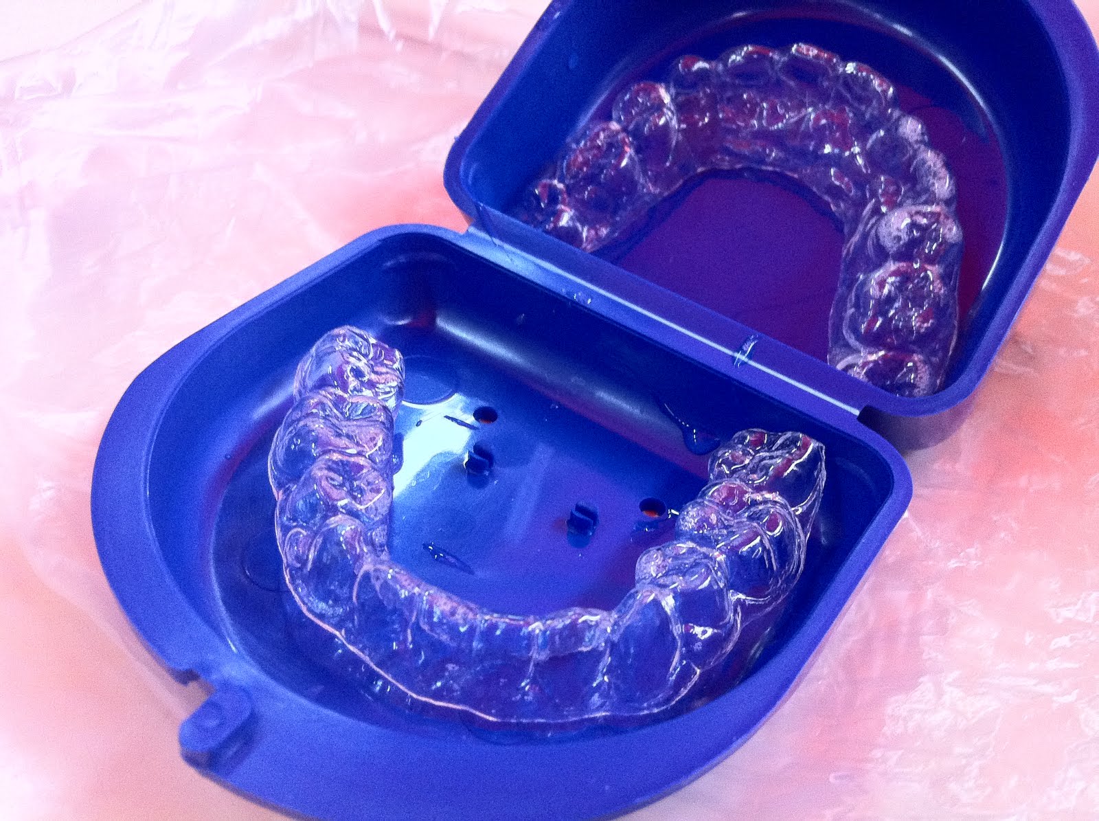 retainers braces invisalign saliva looks disgusting without uncletehpeng took teeth ps eating breakfast