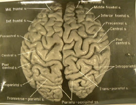 Otak manusia berwarna abu-abu