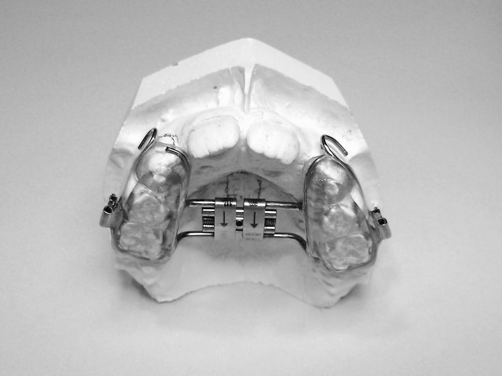 laboratoriodeserafinsalido ORTODONCIA