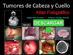 Pulsar la imagen para descargar Tumores de Cabeza y Cuello - Atlas Fotográfico