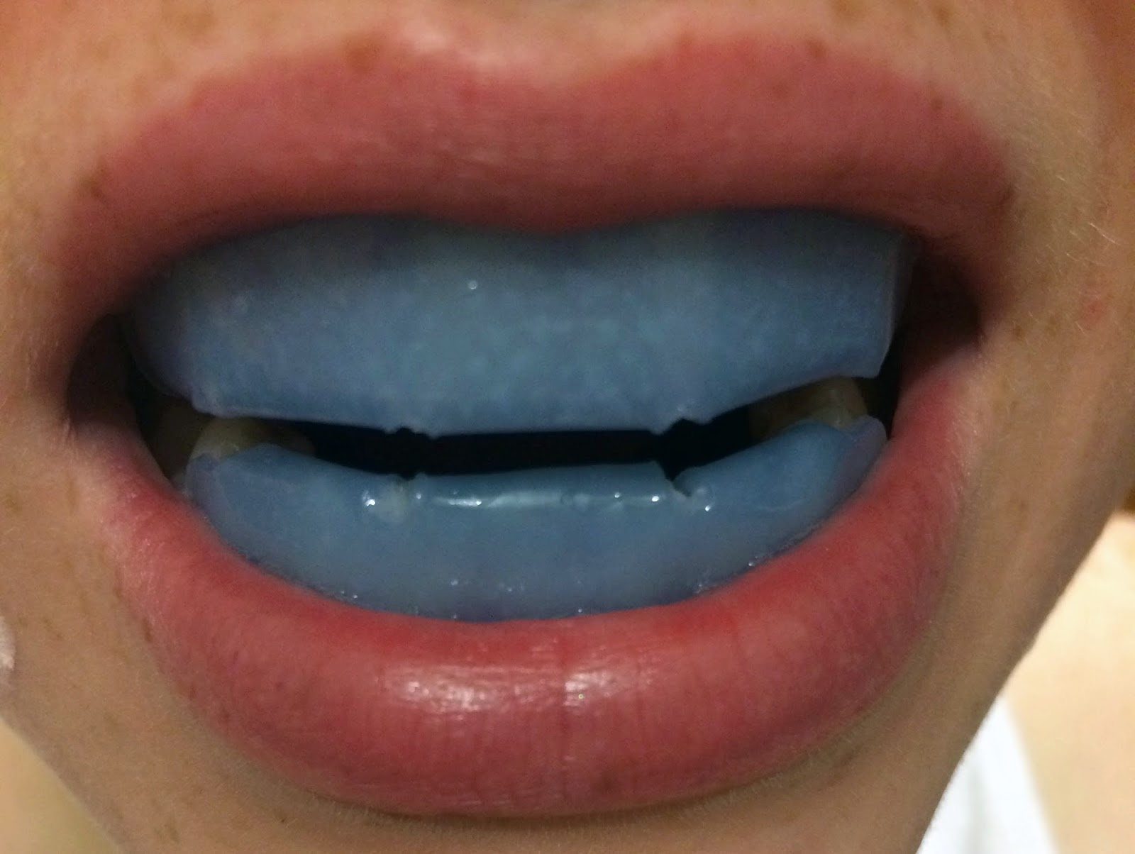 Glazed Over Beauty Up & Up Luminous White Whitening Wraps