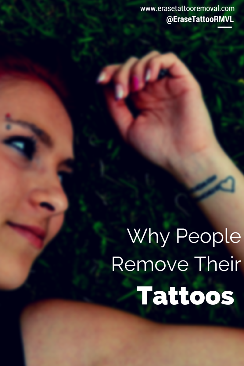 erase tattoo removal why people remove their tattoos erase tattoo removal why people remove their tattoos
