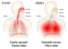 Bird flu 'could mutate to cause deadly human pandemic' 6 220px H1N1 versus H5N1 pathology