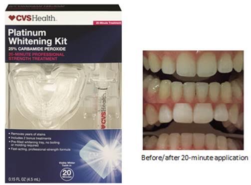 cvs 5 minute whitening kit tooth whitening system review