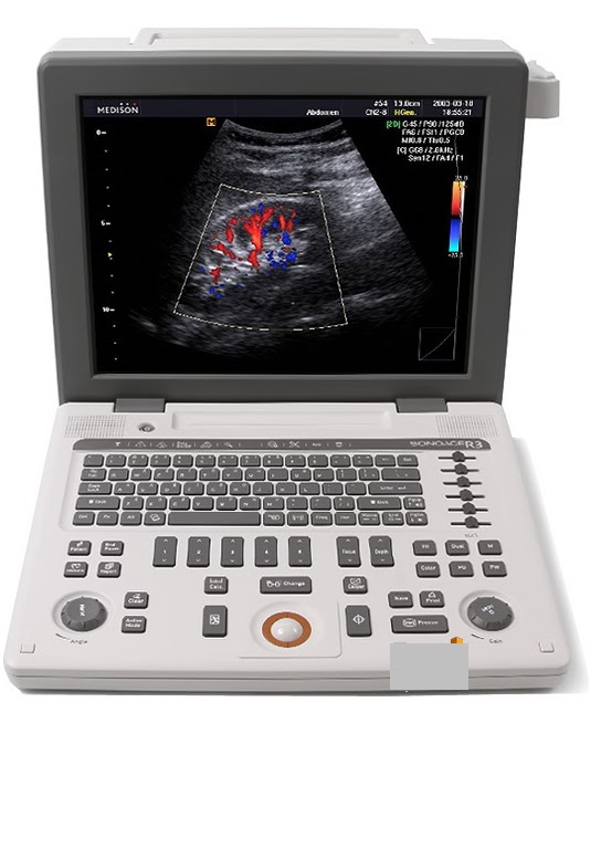 ULTRASOUND Medison SonoAce R3