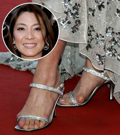 Dr. K. Lam Straight Talk: Michelle Yeoh with bad bunions