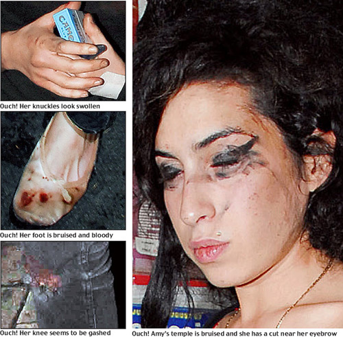 Pictures of Amy Winehouse Dead Exclusive
