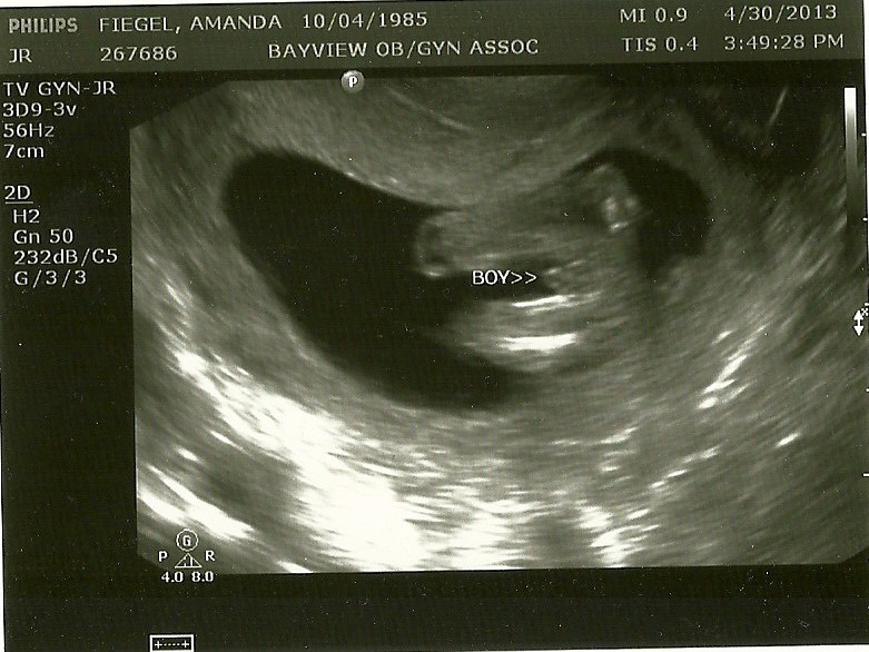 jaxon s journey week 14 ultrasound it s a boy