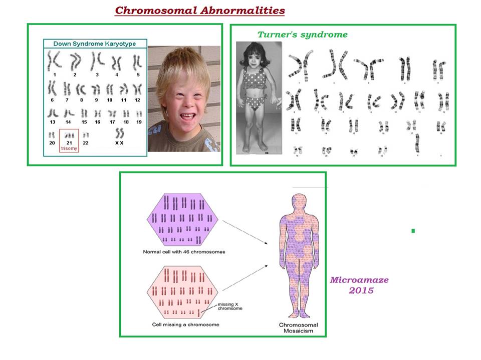 Microamaze Can changes in the number of chromosomes affect health and