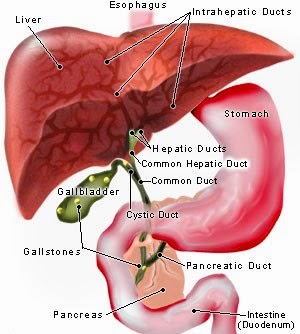 Gall Bladder Stones Homeopathy Treatment in Chennai