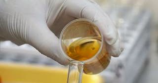 proteinuria causing ckd