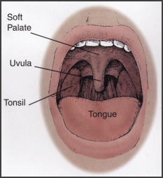 Poor Little Uvula