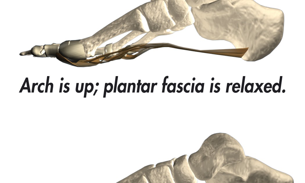 Los Angeles Foot Expert Plantar Fasciitis