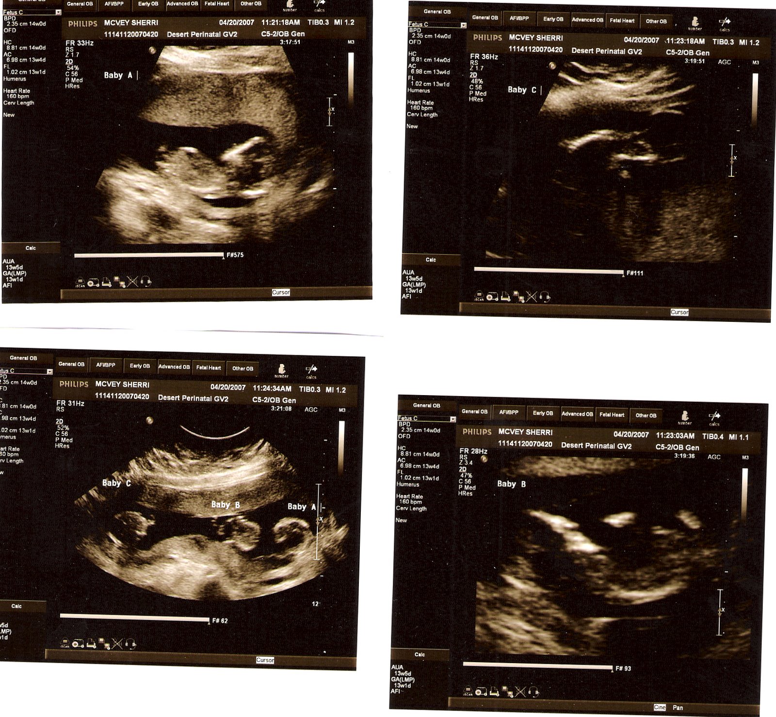 [13+Weeks+-+4-20-07.jpg]