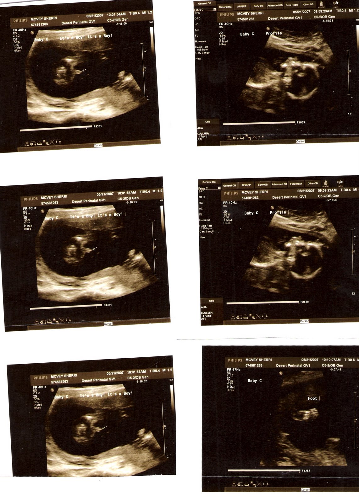 [Babies+II+-+5-21-07+-+17#96.jpg]