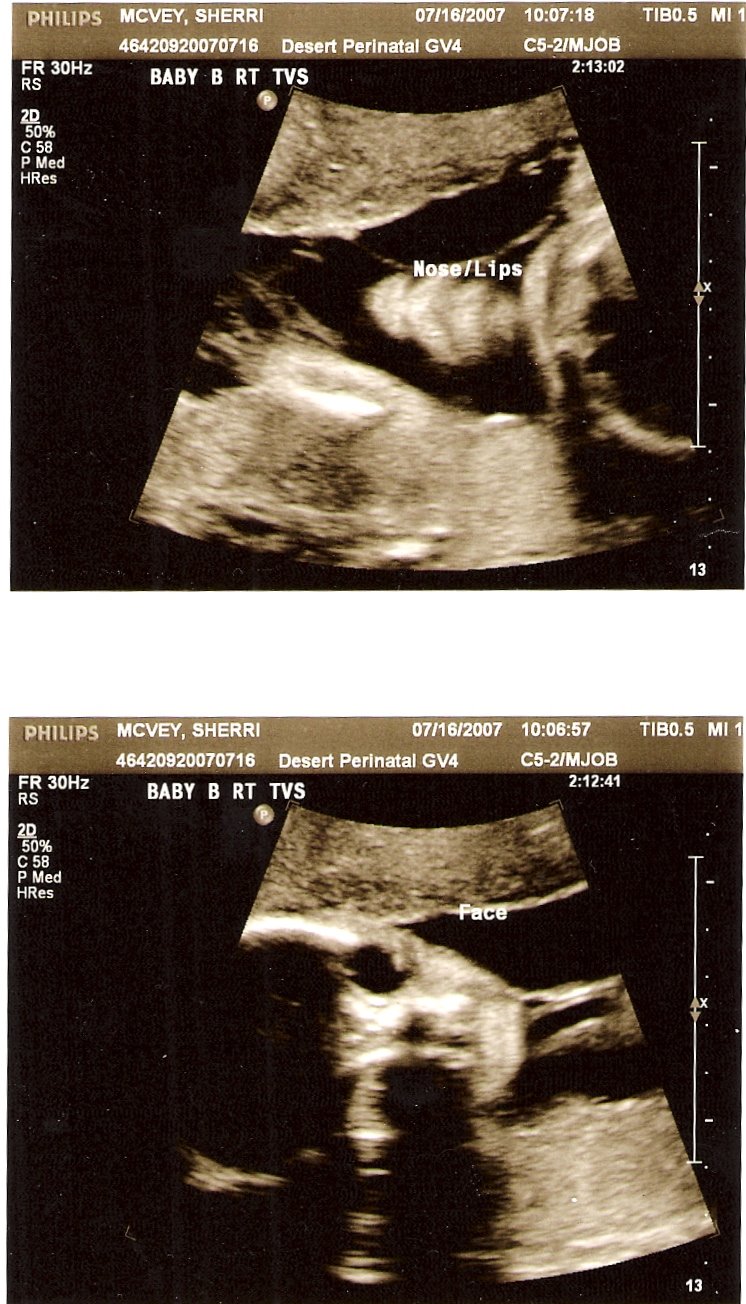 [25.5+Weeks+-+Babies+II+-#98.jpg]
