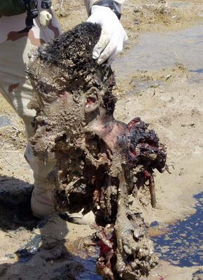Remains of a young suicide