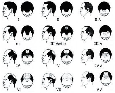 Maschere per capelli con aggiunta di oli