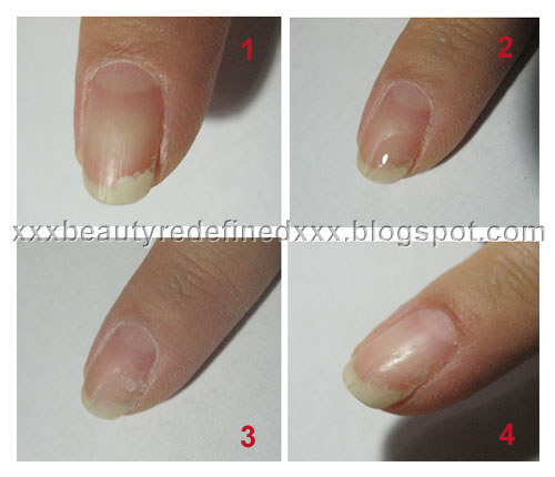Step 1 - crack your nail...not intentionally of course, lol