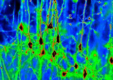 Neurones (from Inserm)