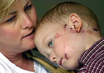 child+attacked+by+coyote.jpg