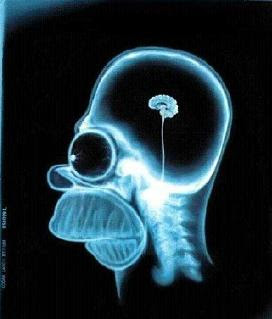 MAS ANTICORRRUPCION... Cerebro+de+Homer