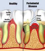 Best+foods+for+healthy+gums+and+teeth