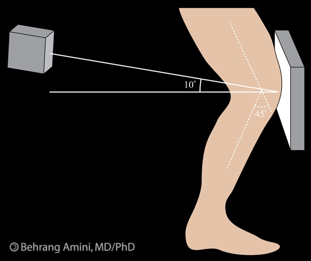 Roentgen Ray Reader The Rosenberg View