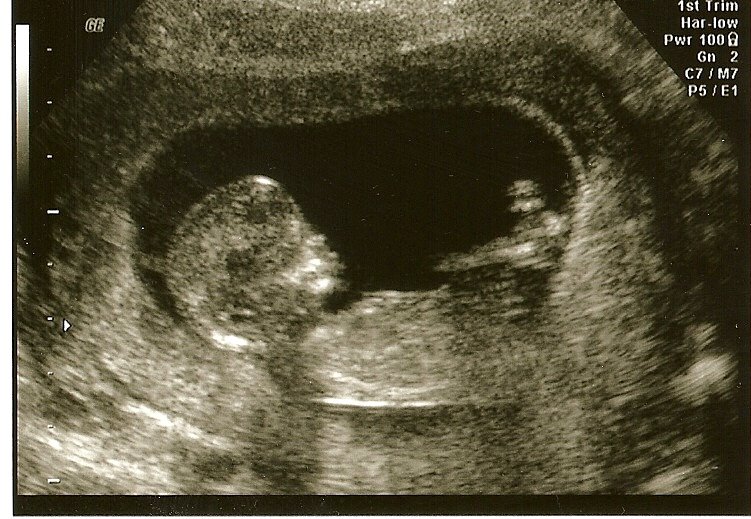 [scan0004.jpg]