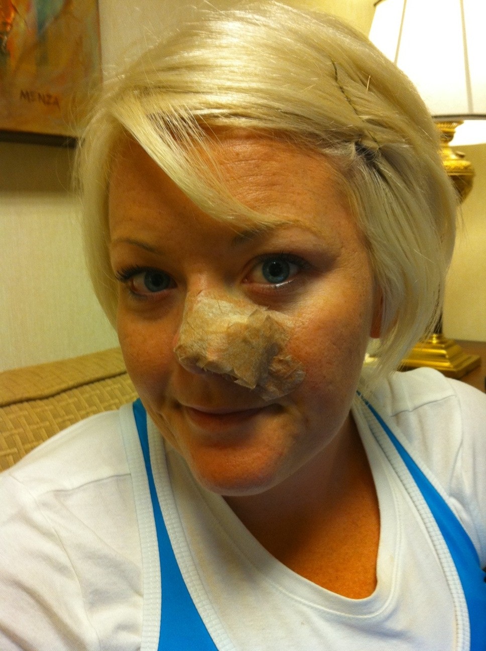 bandage mohs round surgery thicker larger much