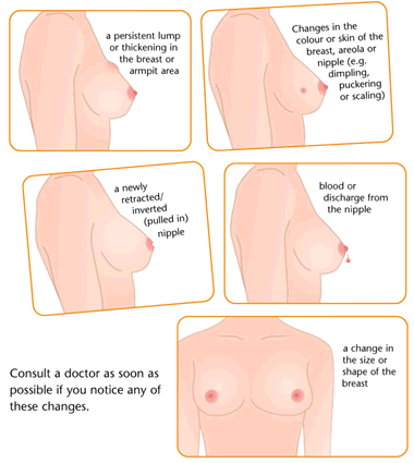 Diagnosa Penyakit Kanker Payudara