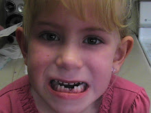 Kinlee's tooth