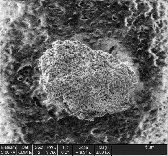 [aaa-+anthrax_spores_SEM1.jpg]