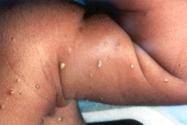 [derm_fig1.jpg]