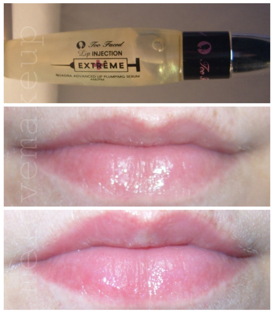 List 95+ Pictures Too Faced Lip Injection Extreme Before And After