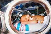 [200px-Human_Infant_in_Incubator.jpg]