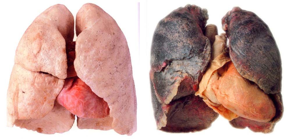 lungs quit smoking
