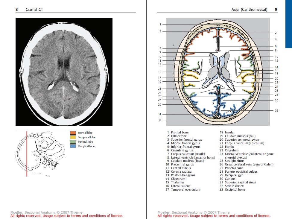 mri brain atlas pdf