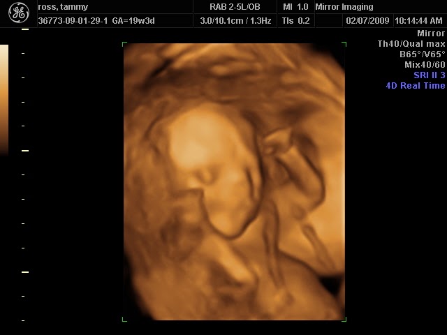 A day in the life of the Ross family: 19 Weeks 4D/3D ultrasound