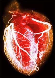 [heartDM_228x320.jpg]