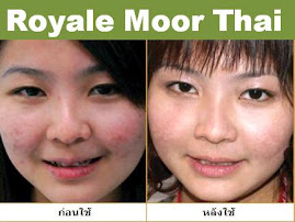 ผู้ใช้ผลิตภัณฑ์ Royale Moor Thai 1