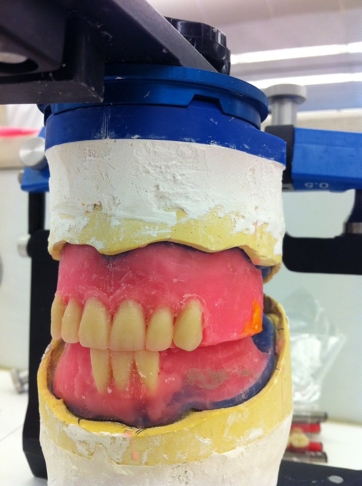 Monoplane Teeth