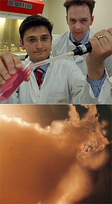 artificial liver