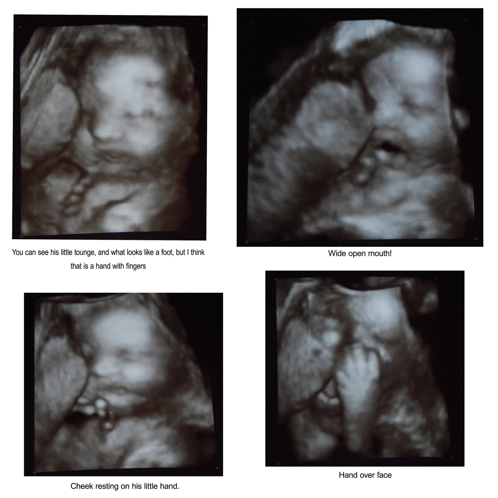 [9-16+32weeks+copy.jpg]