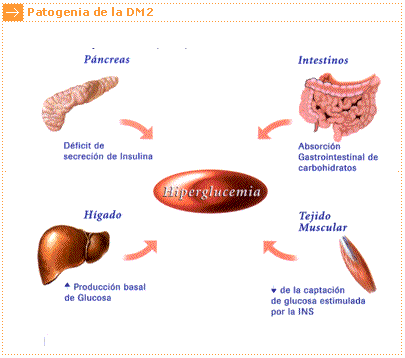 [causas-del-diabetes-mellitus.gif]