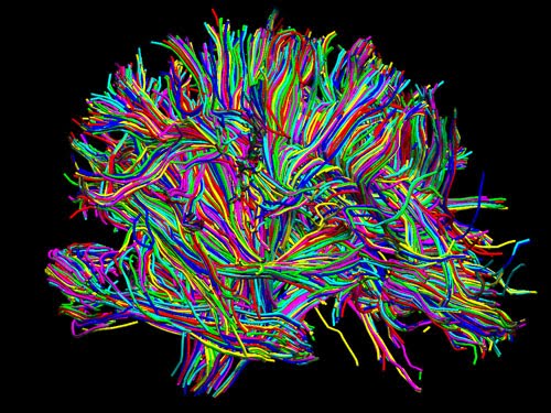 Speed Brain