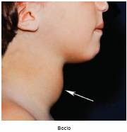 ISLOTES LANGHERHANS PANCREAS islotes langherhans pancreas: